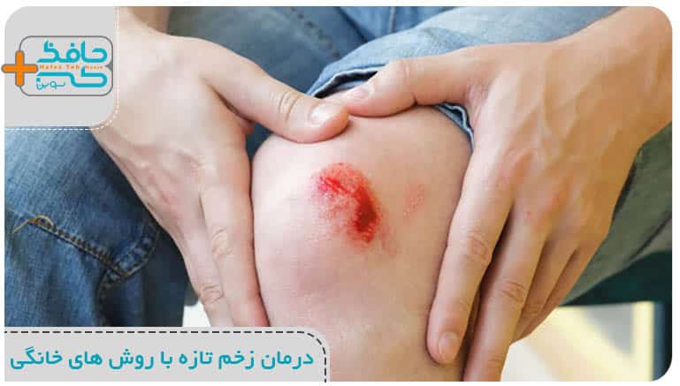 درمان زخم تازه با روش های خانگی