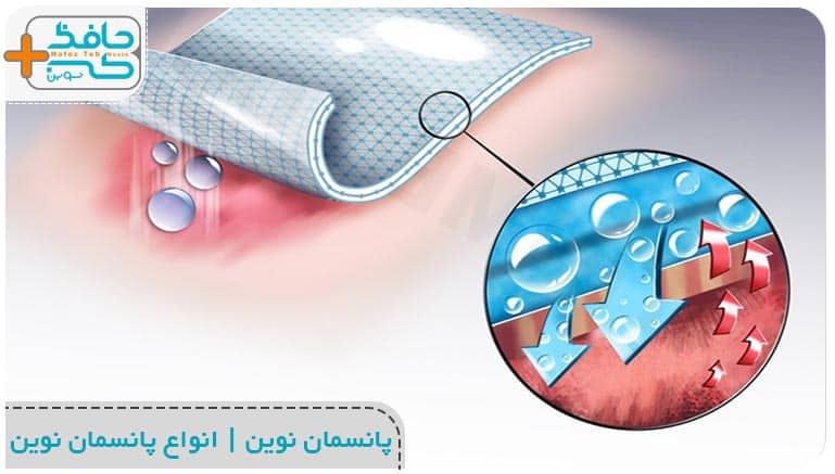 آشنایی با انواع پانسمان نوین