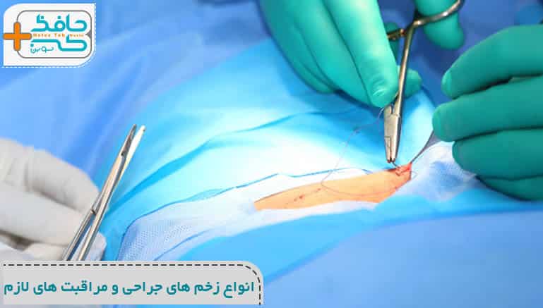 انواع زخم های جراحی و مراقبت های لازم