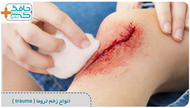 انواع زخم تروما ( trauma ) چیست ؟ | علل | درمان