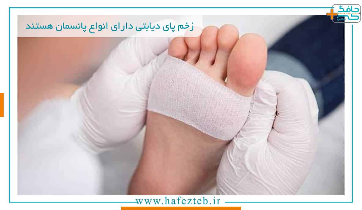 زخم پای دیابتی دارای انواع پانسمان هستند