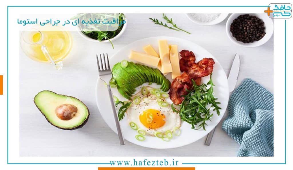 نحوه مراقبت تغذیه ای در جراحی استومی
