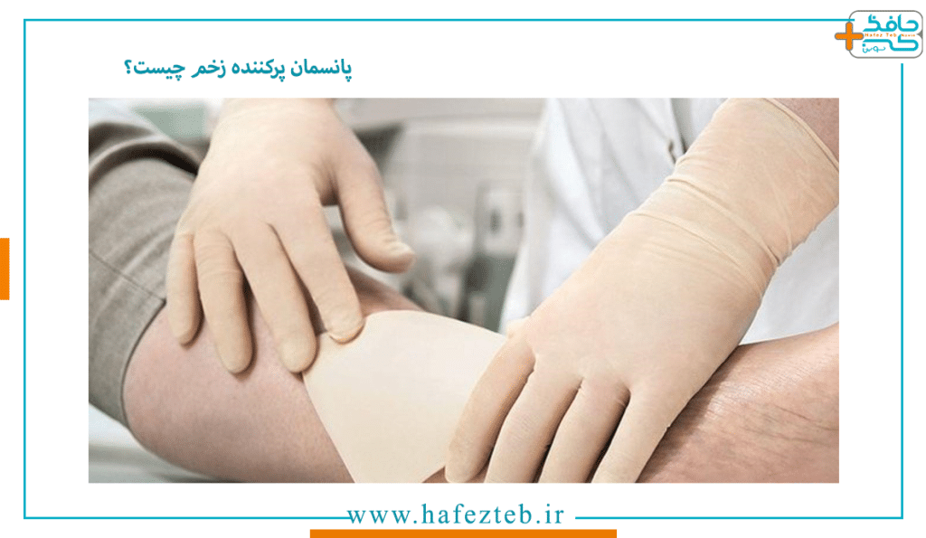 انواع پانسمان پیشگیری از زخم