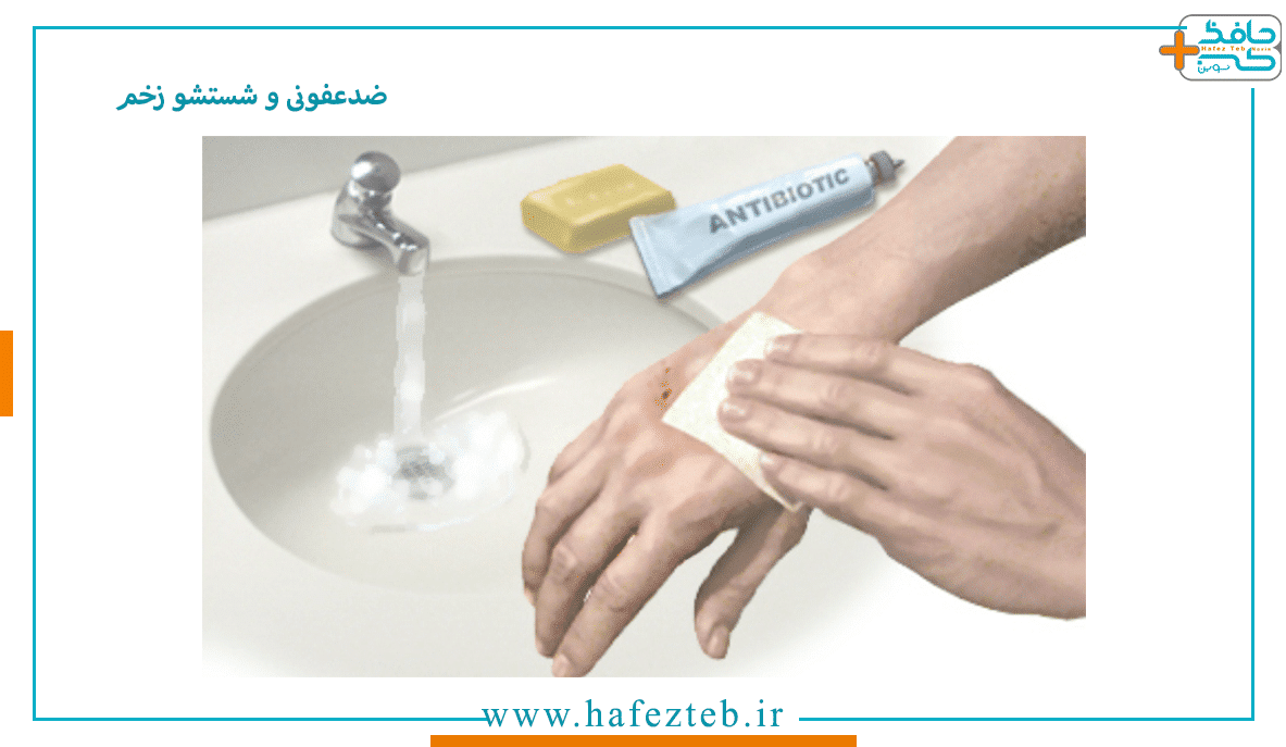 ضدعفونی و شستشو زخم