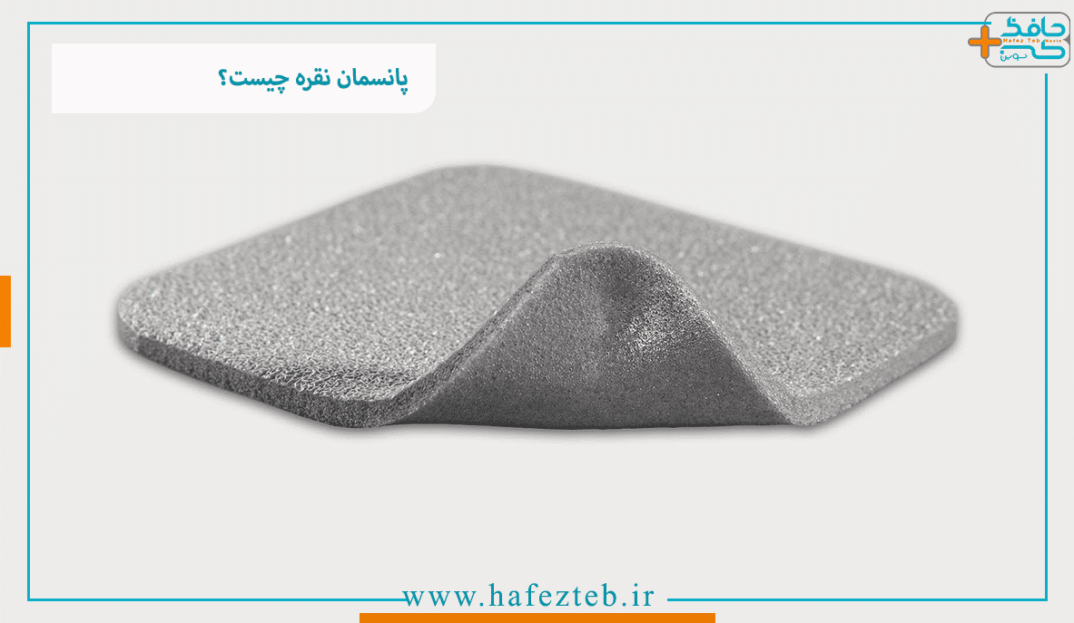 پانسمان نقره چیست؟