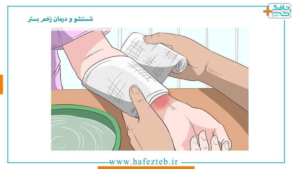 آشنایی با انواع روش های شستشو و درمان زخم بستر