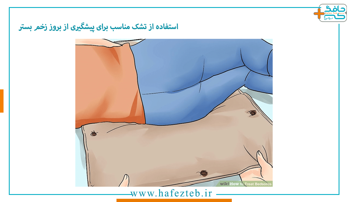 استفاده از تشک مناسب برای پیشگیری از بروز زخم بستر