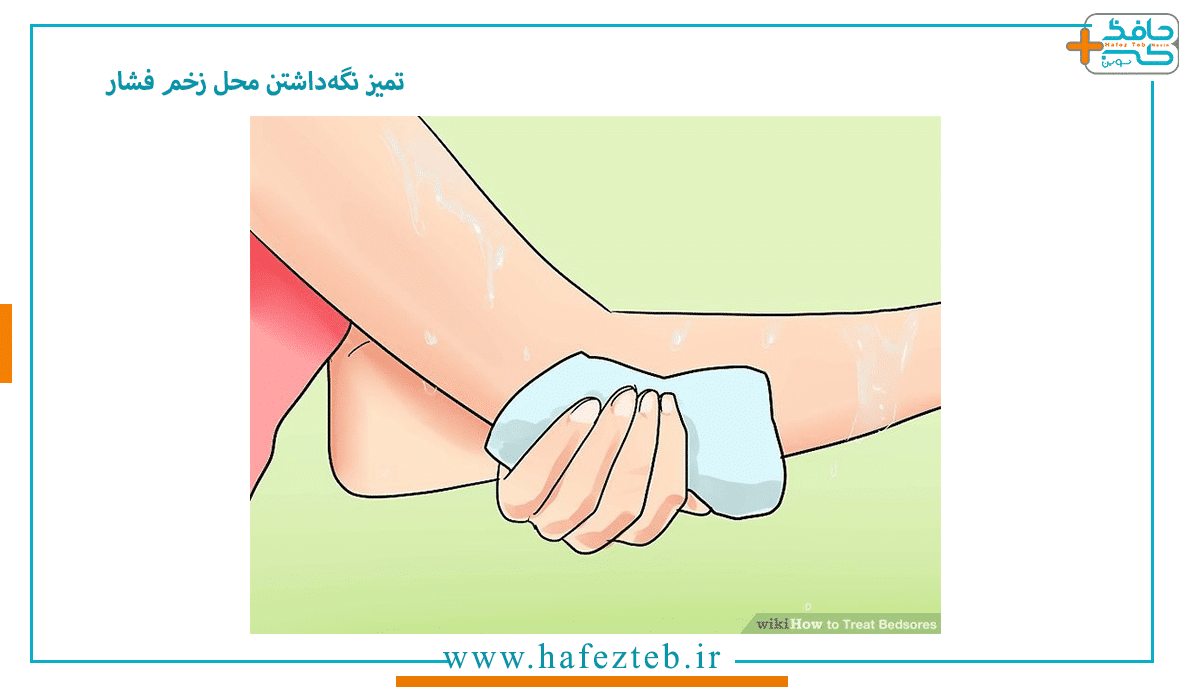 تمیز نگه داشتن محل زخم فشار