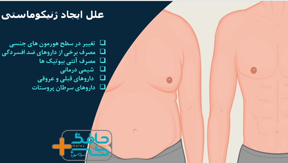 علائم مختلفی مانند برخی از داروها و همچنین عدم تعادل در هورمون های مردانه می تواند منجر به بروز ژنیکوماستی شود