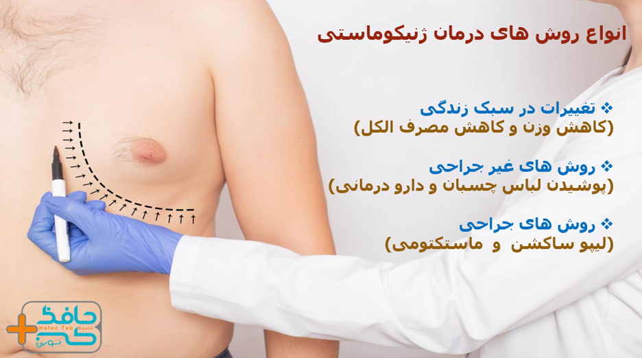Is it better to treat gynecomastia with medication or surgery 4 ژنیکوماستی با دارو بهتر است یا جراحی؟