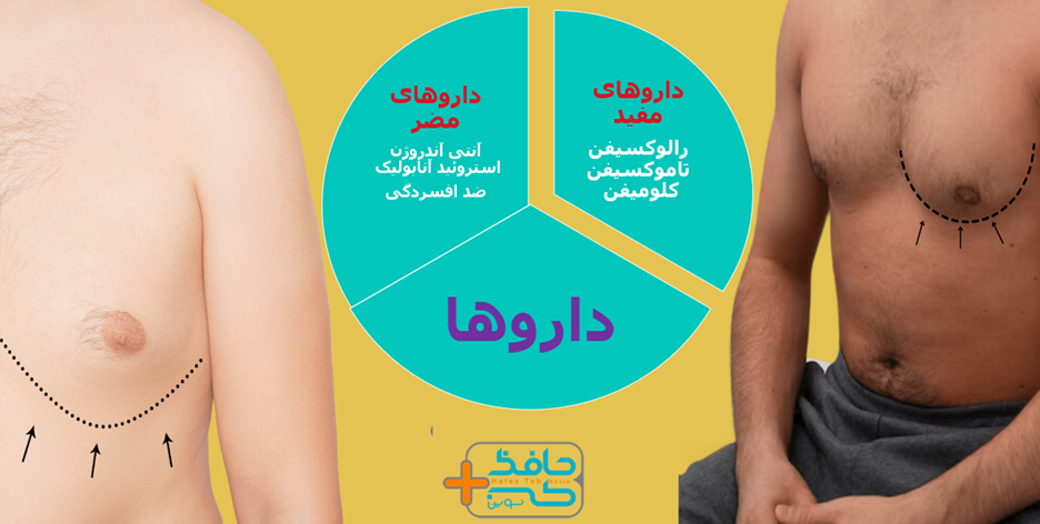 Is it better to treat gynecomastia with medication or surgery 5 ژنیکوماستی با دارو بهتر است یا جراحی؟