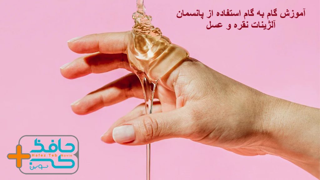 آموزش گام به گام استفاده از پانسمان آلژینات نقره و عسل
