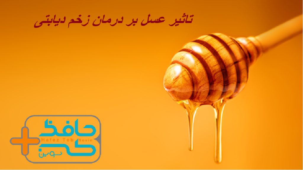 تاثیر عسل بر درمان زخم دیابتی