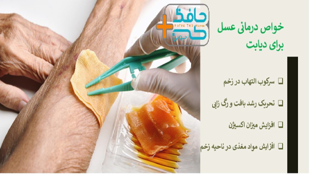 The effect of honey on the treatment of diabetic ulcers 3 1 تاثیر عسل بر درمان زخم دیابتی