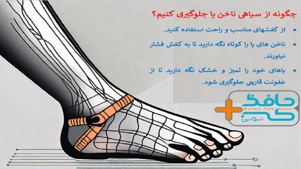 برای پیشگیری از سیاهی ناخن های انگشت های پا چکار کنیم؟