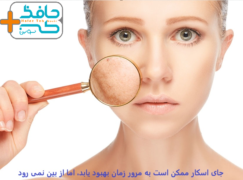 مراقبت های پس از ایجاد زخم، در تسریع روند بهبود زاسکار بسیار اهمیت دارند