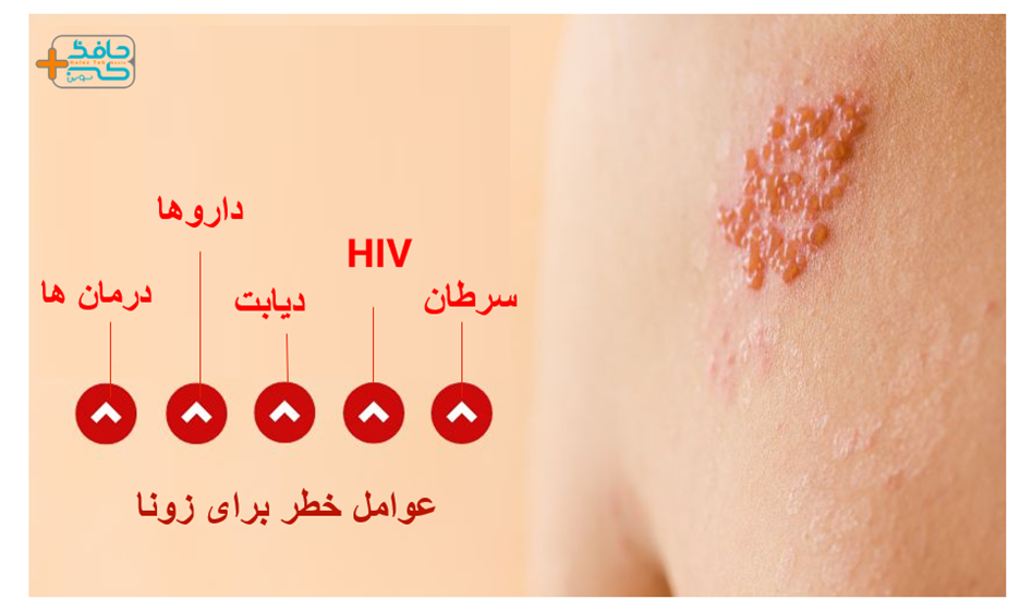 قیمت واکسن آبله مرغان 1404