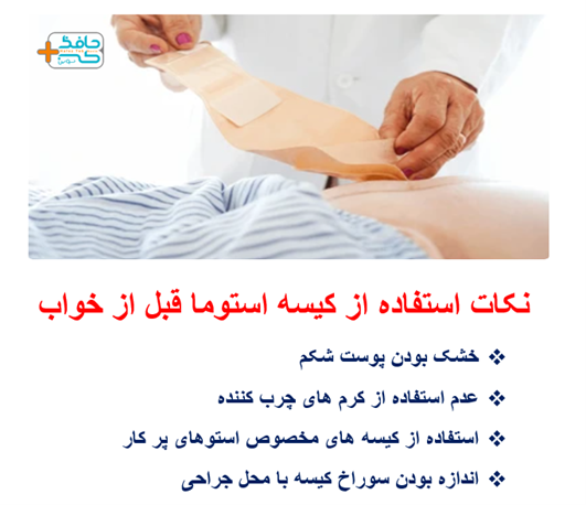 خالی کردن کیسه قبل از خواب و انتخاب کیهس متناسب با اندازه سوراخ جراحی به شما کمک می کند تا راحت بخوابید