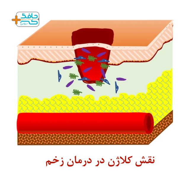 نقش کلاژن در درمان زخم