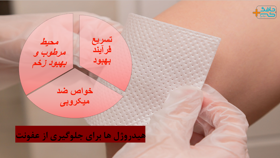 The role of hydrogels in keeping wounds moist and preventing infection 4 هیدروژل