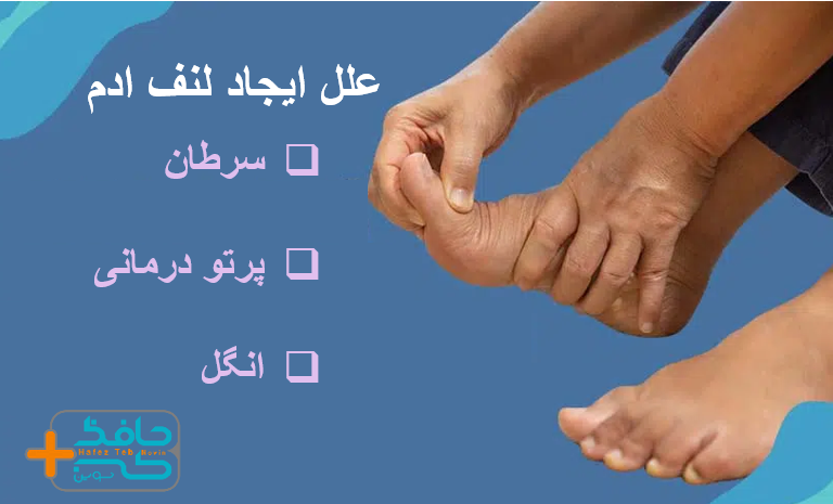 روش های درمانی سرطان یکی از علل اصلی ایجاد لنف ادم می باشد