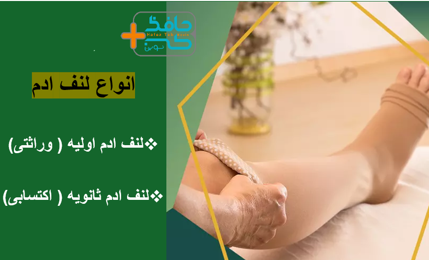 What is lymphedema and how is it treated3 لنف چیست؟