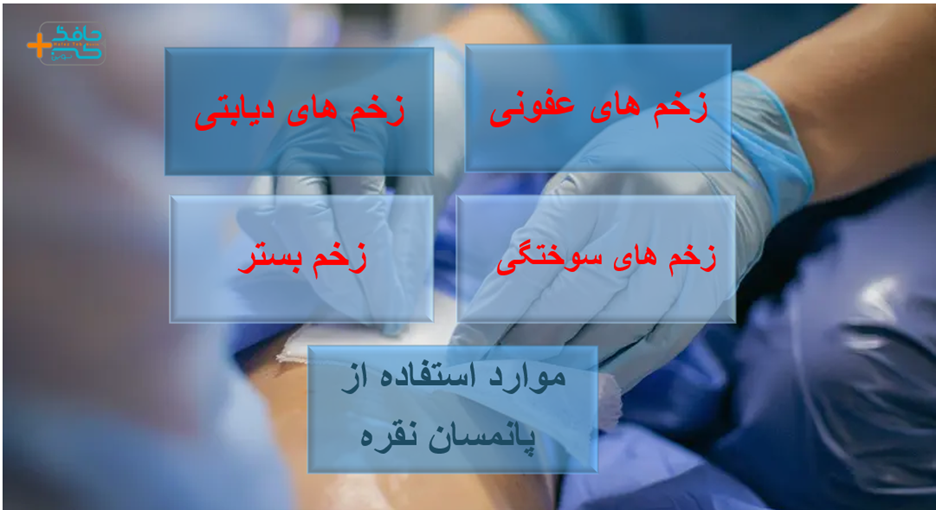 از پانسمان نقره می توانید در درمان زخم های حاد و مزمن استفاده کنید و روند درمان را بهبود دهید