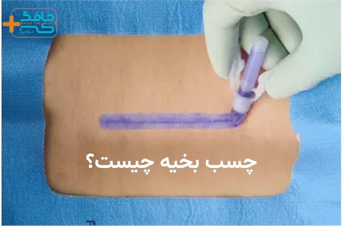چسب بخیه چیست؟