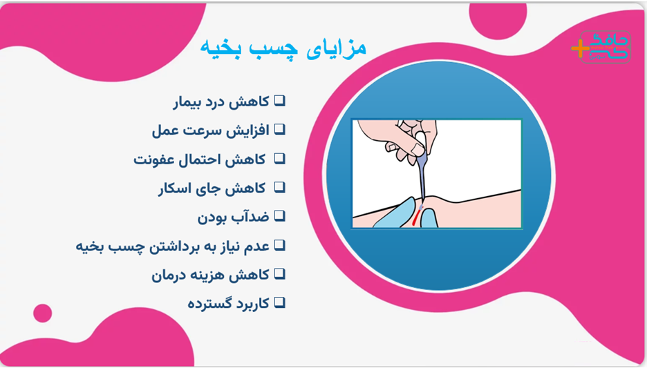 چسب بخیه گاربردهای گسترده برای زخم های کودکان و زخم های سطحی و جراحی پلاستیک کاربرد دارد