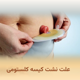 علت نشت کیسه کلستومی