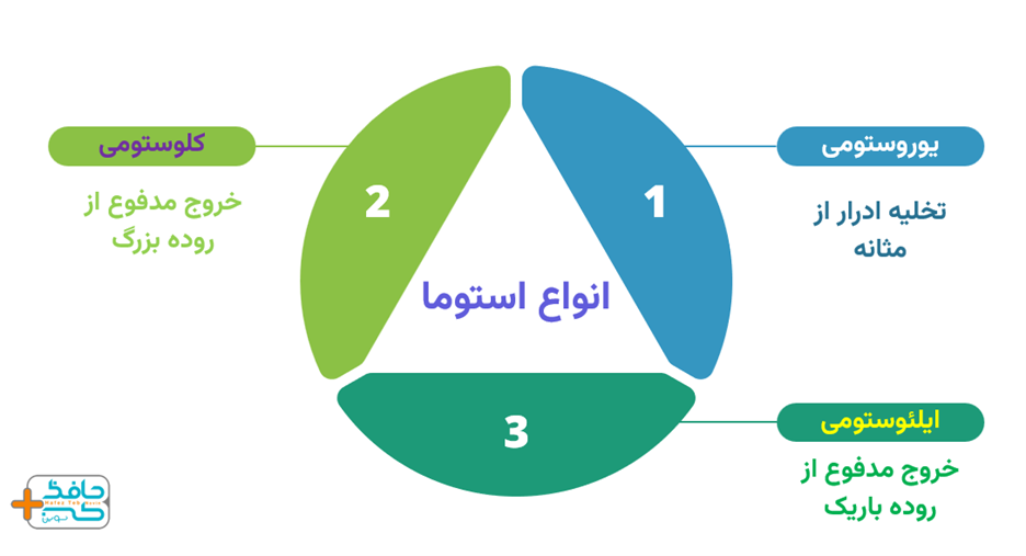 سه نوع استوما داریم که می توانند موقتی و یا دائمی باشند