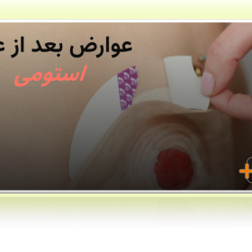 عوارض بعد از عمل استومی