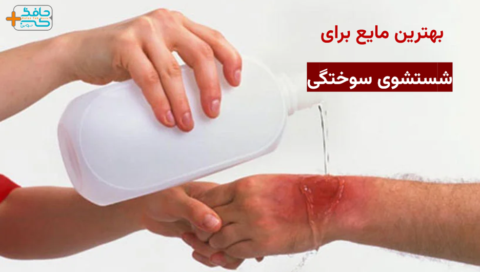بهترین مایع برای شستشوی سوختگی