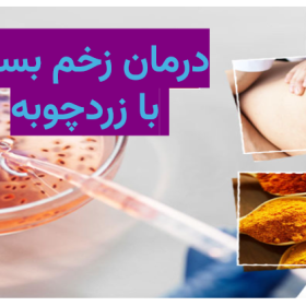 درمان زخم بستر با زردچوبه