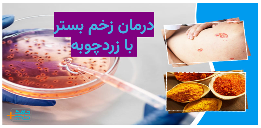 درمان زخم بستر با زردچوبه